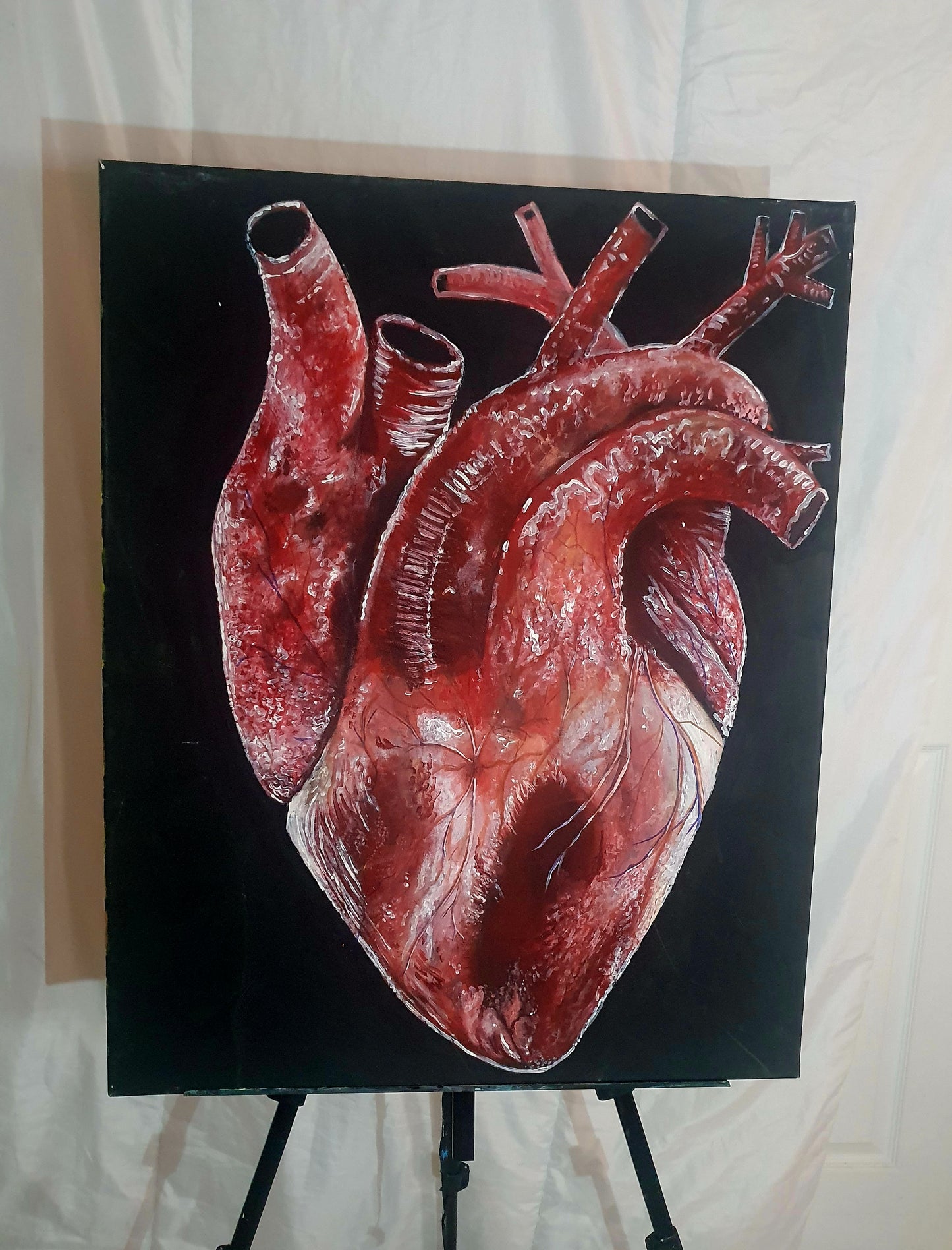 Heart attack